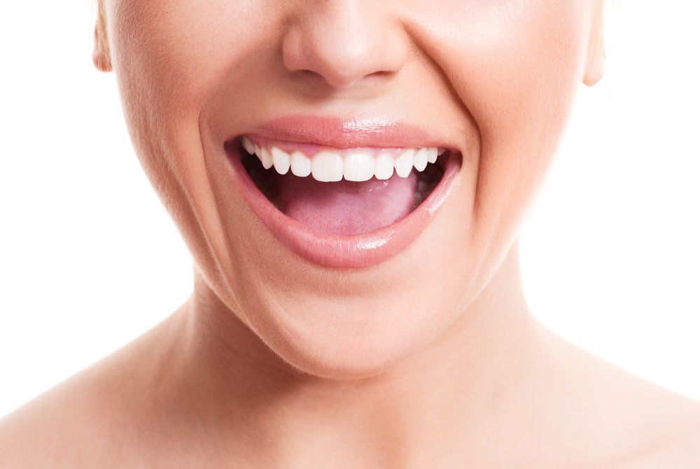 Up-close shot of smiling woman with healthy teeth